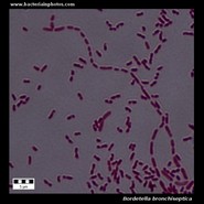 bordetella bronchiseptica under microscope